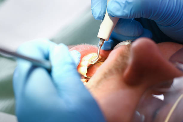 Best Weekend Emergency Dentist in Ferguson, MO