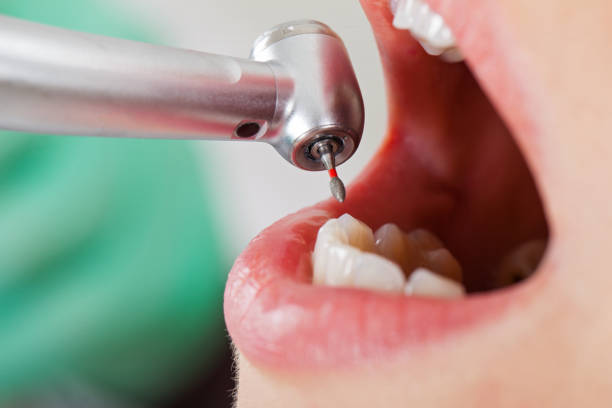 Best Cosmetic Emergency Dentistry in Ferguson, MO